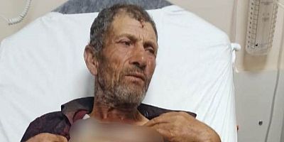 Babakonağı Köyünde Domuz Saldırısı: 1 Yaralı