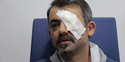 Gümüşhane’de gözüne Japon yapıştırıcısı kaçan kişi hastanelik oldu
