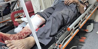Kelkit’te Odun Keserken Kaza: Yaşlı Vatandaş Kendi Bacağını Kesti