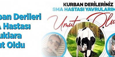 Kurban derileri SMA hastası çocuklara umut oldu